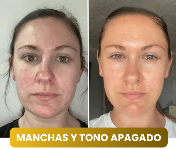 Mascarilla Facial Coreana con Cúrcuma y Colágeno