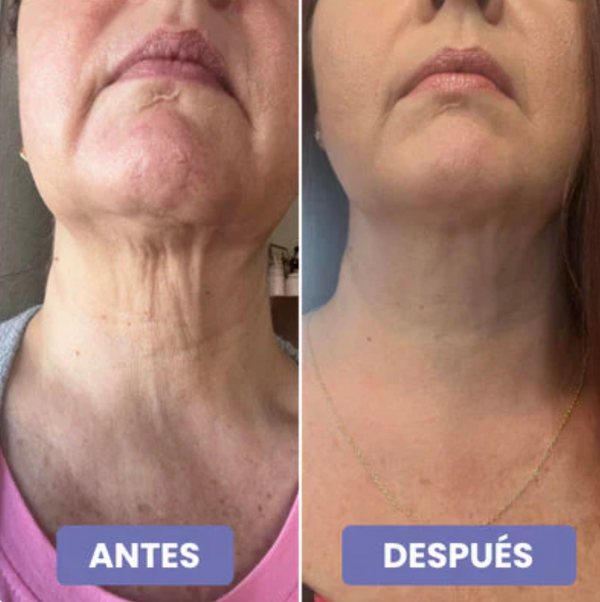 Crema antienvejecimiento para el cuello