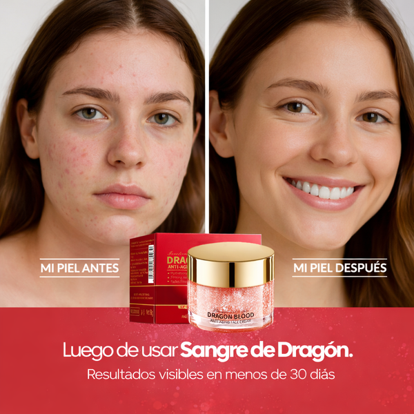 Crema Hidratante Sangre de Dragón