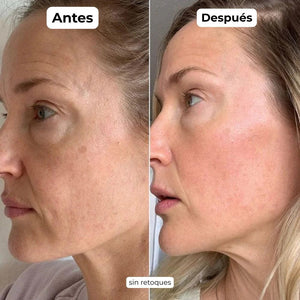 Mascarillas de Bio Colágeno